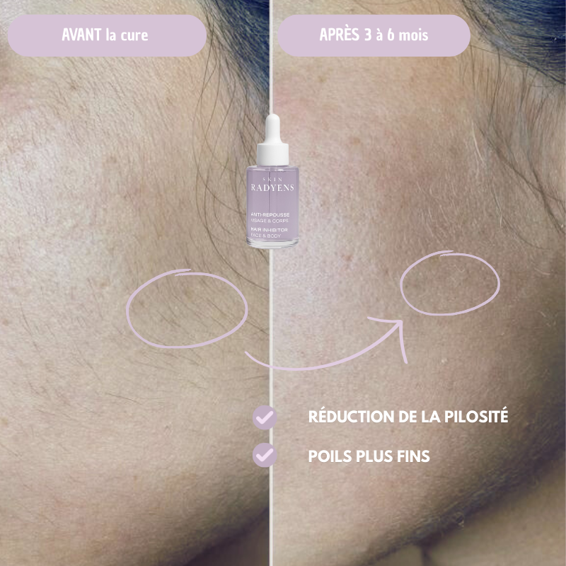 Huile Anti-Repousse de poils