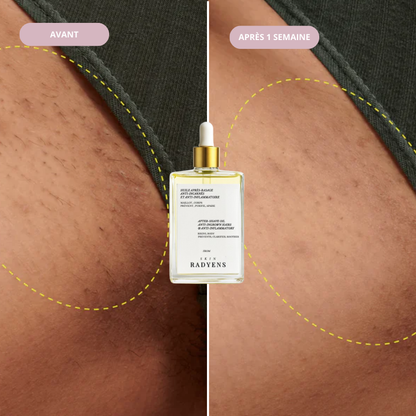 Huile Anti-Incarnés (100ml)