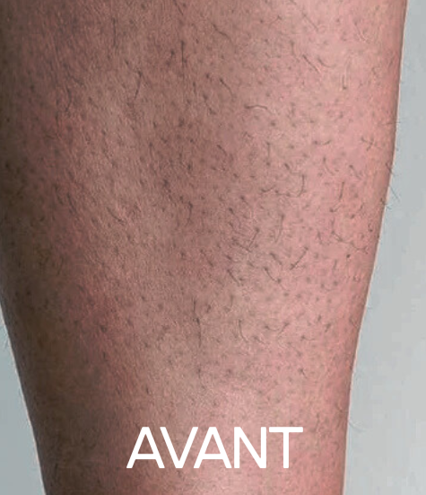 AVANT