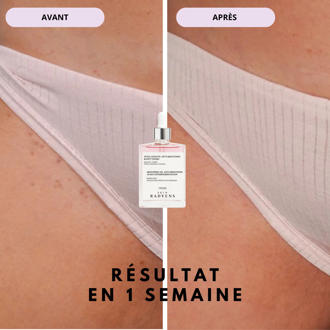 Huile Anti-Hyperpigmentation Post-rasage