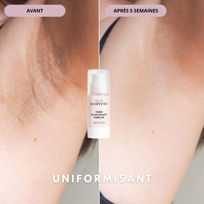 Crème Éclaircissante Aisselles