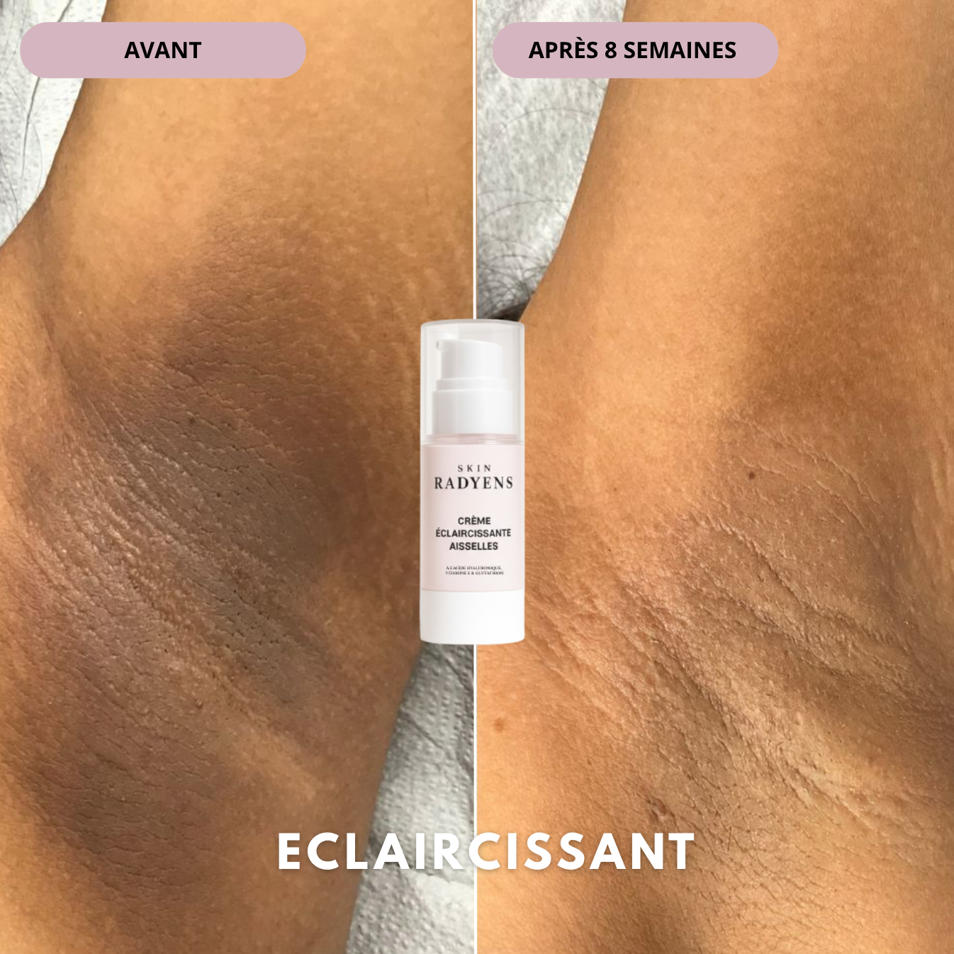Crème Éclaircissante Aisselles