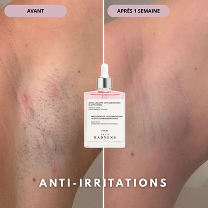 Huile Anti-Hyperpigmentation Post-rasage