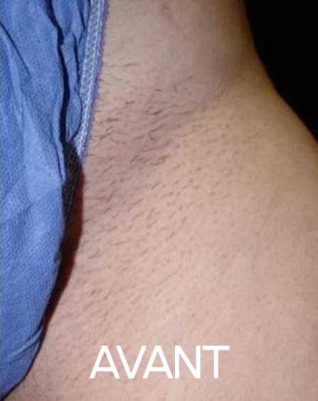 AVANT