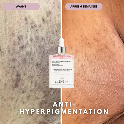 Huile Anti-Hyperpigmentation Post-rasage
