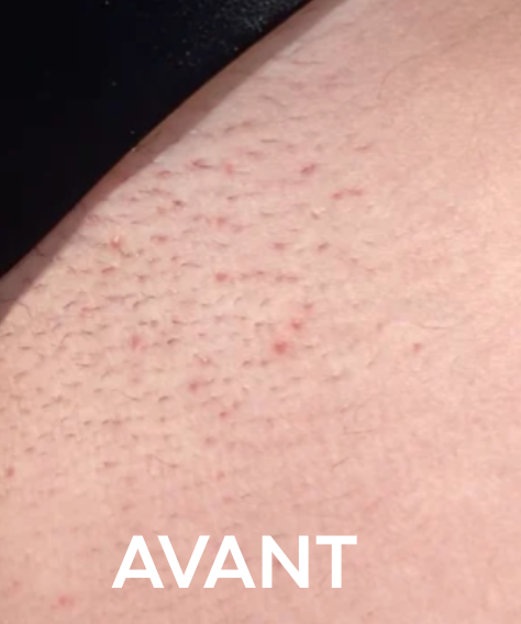 AVANT