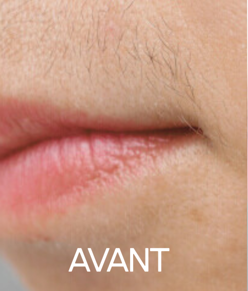 AVANT
