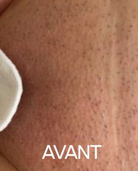 AVANT