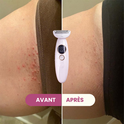 Rasoir 5 en 1 - RADYENS®