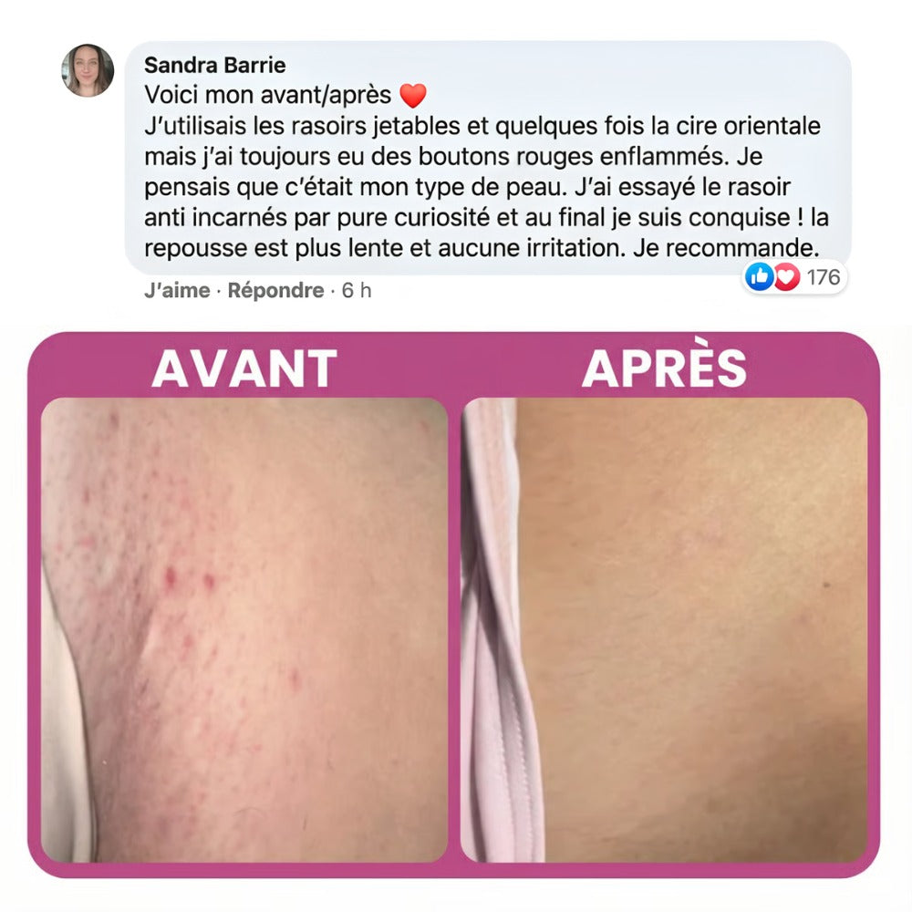 Rasoir 5 en 1 - RADYENS®